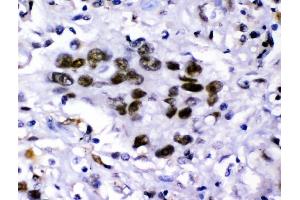 IHC analysis of KDM5B using anti-KDM5B antibody (ABIN4886648). (KDM5B antibody  (Middle Region))