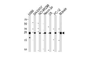 UCHL1 antibody  (C-Term)