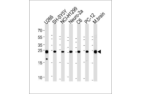 UCHL1 antibody  (C-Term)