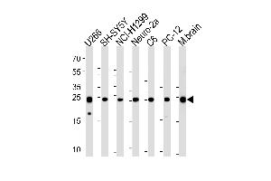 UCHL1 Antibody (C-term) (ABIN1882188 and ABIN2839165) western blot analysis in ,SH-SY5Y,NCI-,mouse Neuro-2a,rat C6,PC-12 cell line and mouse brain tissue lysates (35 μg/lane). (UCHL1 antibody  (C-Term))
