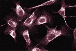Immunofluorescent staining of Human Endothelial cells. (RAB5 antibody  (AA 1-215))
