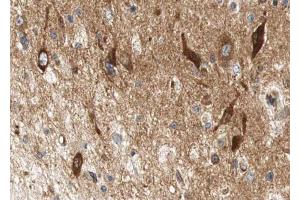 ABIN6267612 at 1/100 staining human brain tissue sections by IHC-P. (LIPE antibody  (pSer552))