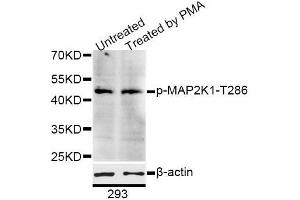 Western blot analysis of extracts of 293 cells, using Phospho-MAP2K1-T286 antibody (ABIN5995642) at 1/1000 dilution. (MEK1 antibody  (pThr285))