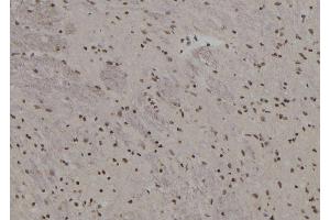 Immunohistochemistry (IHC) image for anti-BTB and CNC Homology 1, Basic Leucine Zipper Transcription Factor 2 (BACH2) (Internal Region) antibody (ABIN6257741)