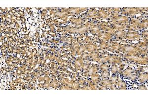 Immunohistochemistry (IHC) image for anti-Receptor (TNFRSF)-Interacting serine-threonine Kinase 1 (RIPK1) (AA 17-289) antibody (ABIN7441202)