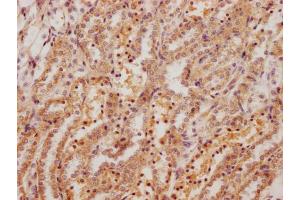 IHC image of ABIN7178861 diluted at 1:200 and staining in paraffin-embedded rat kidney tissue performed on a Leica BondTM system. (Fibronectin 1 antibody  (AA 1175-1451))