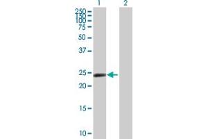 Western Blot analysis of ZNF501 expression in transfected 293T cell line by ZNF501 MaxPab polyclonal antibody.