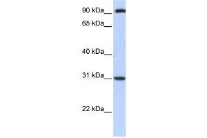 Western Blotting (WB) image for anti-Ankyrin Repeat, Family A (RFXANK-Like), 2 (ANKRA2) antibody (ABIN2459440) (ANKRA2 antibody)