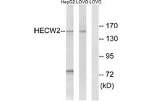 Western Blotting (WB) image for anti-HECT, C2 and WW Domain Containing E3 Ubiquitin Protein Ligase 2 (HECW2) (AA 481-530) antibody (ABIN2890283) (HECW2 antibody  (AA 481-530))