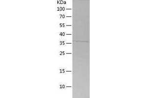 Western Blotting (WB) image for Septin 9 (SEPT9) (AA 117-240) protein (His-IF2DI Tag) (ABIN7282818) (Septin 9 Protein (SEPT9) (AA 117-240) (His-IF2DI Tag))