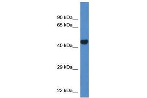 WB Suggested Anti-Pcyt2 Antibody Titration: 1. (PCYT2 antibody  (N-Term))