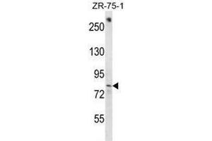 BACH1 Antibody (C-term) western blot analysis in ZR-75-1 cell line lysates (35µg/lane). (BACH1 antibody  (C-Term))