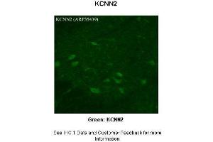 Sample Type :  Rhesus macaque spinal cord  Primary Antibody Dilution :  1:300  Secondary Antibody :  Donkey anti Rabbit 488  Secondary Antibody Dilution :  1:500  Color/Signal Descriptions :  Green: KCNN2  Gene Name :  KCNN2  Submitted by :  Timur Mavlyutov, Ph. (KCNN2 antibody  (Middle Region))