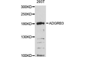 Western blot analysis of extracts of 293T cells, using ADGRB3 antibody (ABIN6290299) at 1:3000 dilution. (BAI3 antibody)