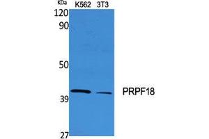 Western Blot (WB) analysis of specific cells using PRPF18 Polyclonal Antibody. (PRPF18 antibody  (Internal Region))