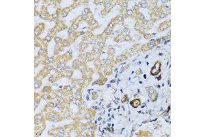 Immunohistochemistry of paraffin-embedded human liver using CSH1 antibody at dilution of 1:100 (40x lens). (CSH1 antibody)