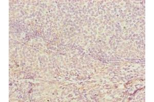 Immunohistochemistry of paraffin-embedded human tonsil tissue using ABIN7149078 at dilution of 1:100 (CDADC1 antibody  (AA 1-99))
