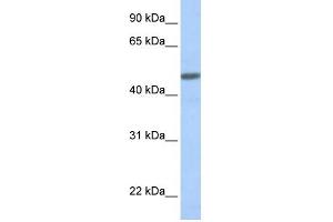 WB Suggested Anti-CALCRL Antibody Titration:  0.