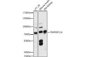 Western blot analysis of extracts of various cell lines, using TNFRSF11A antibody (ABIN6127588, ABIN6149309, ABIN6149311 and ABIN6216817) at 1:3000 dilution. (TNFRSF11A antibody  (AA 466-616))