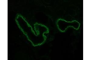 Image no. 2 for anti-Integrin, alpha 3 (ITGA3) (Cytoplasmic Domain) antibody (ABIN959430) (ITGA3 antibody  (Cytoplasmic Domain))