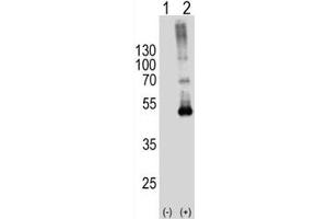 Western blot analysis of SPHK1 antibody and 293T cell lysate either nontransfected (Lane 1) or transiently transfected (2) with the SPHK1 gene. (SPHK1 antibody  (AA 1-30))