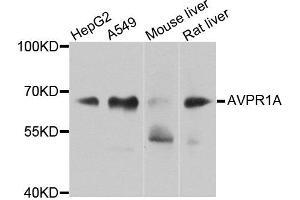 Western blot analysis of extracts of various cells, using AVPR1A antibody.
