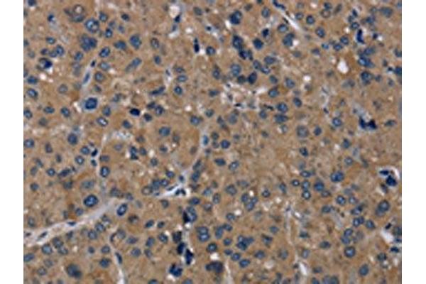 TRPM1 antibody