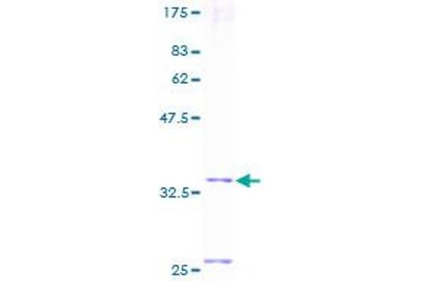 MGP Protein (AA 1-103) (GST tag)