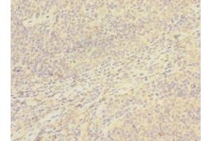 Immunohistochemistry of paraffin-embedded human tonsil tissue using ABIN7171407 at dilution of 1:100 (CD8B antibody  (AA 22-170))