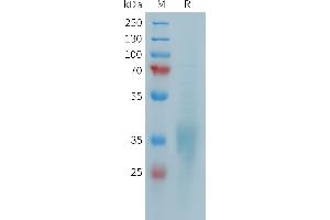 SDS-PAGE (SDS) image for CD28 (CD28) (AA 19-152) protein (His tag) (ABIN7538170)