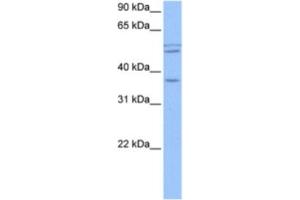 Western Blotting (WB) image for anti-Coiled-Coil Domain Containing 78 (CCDC78) antibody (ABIN2463547) (CCDC78 antibody)
