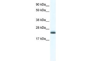 WB Suggested Anti-Tppp Antibody Titration:  1. (Tppp antibody  (C-Term))