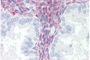 Human Uterus (formalin-fixed, paraffin-embedded) stained with LRP1 antibody ABIN351532 at 10 ug/ml followed by biotinylated anti-mouse IgG secondary antibody ABIN481714, alkaline phosphatase-streptavidin and chromogen. (LRP1 antibody)