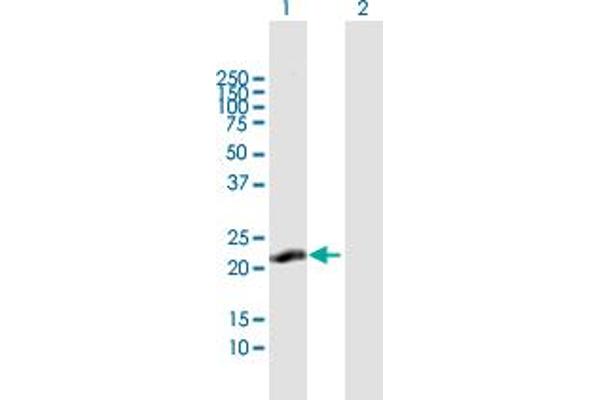 CLLD6 antibody  (AA 1-196)