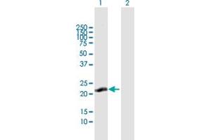 Western Blot analysis of C13orf1 expression in transfected 293T cell line by C13orf1 MaxPab polyclonal antibody. (CLLD6 antibody  (AA 1-196))