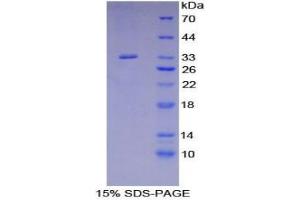 SDS-PAGE analysis of Human SHB Protein. (Src Homology 2 Domain Containing Adapter Protein B Protein)