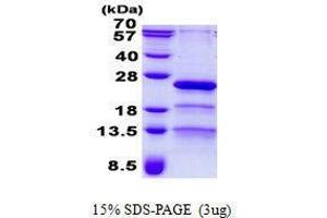 Figure annotation denotes ug of protein loaded and % gel used. (RP9 Protein)