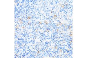 Immunohistochemistry of paraffin-embedded rat spleen using CD11a/LFA-1A/ITGAL antibody (ABIN3015541, ABIN3015542, ABIN3015543, ABIN1680526 and ABIN6218728) at dilution of 1:100 (40x lens). (ITGAL antibody  (AA 26-306))