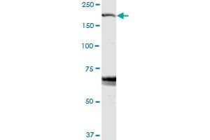 ZFYVE9 MaxPab rabbit polyclonal antibody. (ZFYVE9 antibody  (AA 1-762))