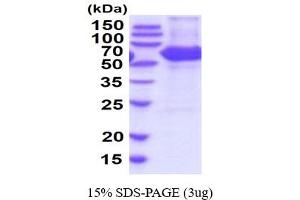 SDS-PAGE (SDS) image for Carboxylesterase 1D (CES1D) (AA 19-565) (Active) protein (His tag) (ABIN7281177) (Carboxylesterase 1D (CES1D) (AA 19-565) (Active) protein (His tag))