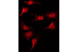 ABIN6269194 staining COLO205 by IF/ICC. (Cofilin antibody  (N-Term))