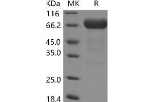 Western Blotting (WB) image for EPH Receptor A3 (EPHA3) (Active) protein (His tag) (ABIN7195523) (EPH Receptor A3 Protein (EPHA3) (His tag))