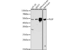 Western blot analysis of extracts of various cell lines, using PLGF antibody (ABIN3015554, ABIN3015555, ABIN3015556 and ABIN6218826) at 1:1000 dilution. (PLGF antibody  (AA 19-170))