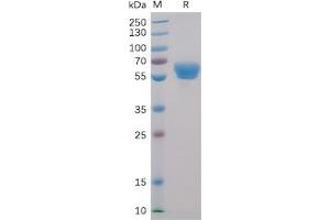 Human 4-1BB Protein, mFc-His Tag on SDS-PAGE under reducing condition. (CD137 Protein (mFc-His Tag))