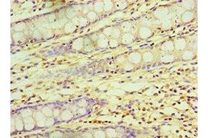 Immunohistochemistry of paraffin-embedded human colon tissue using ABIN7145839 at dilution of 1:100 (KCTD15 antibody  (AA 1-234))
