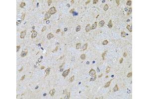 Immunohistochemistry of paraffin-embedded Mouse brain using NFU1 Polyclonal Antibody at dilution of 1:100 (40x lens). (NFU1 antibody)
