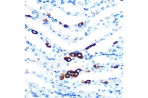 Immunohistochemistry of paraffin-embedded mouse kidney using PIWIL1 Rabbit mAb (ABIN7269381) at dilution of 1:100 (40x lens). (PIWIL1 antibody)
