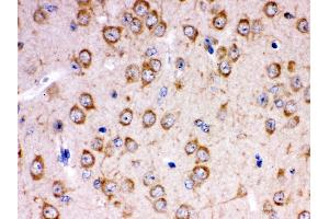 Anti- KCNIP2 Picoband antibody,IHC(P) IHC(P): Rat Brain Tissue (KCNIP2 antibody  (N-Term))