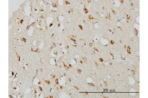 Immunoperoxidase of monoclonal antibody to SERPINI1 on formalin-fixed paraffin-embedded human cerebral cortex. (Neuroserpin antibody  (AA 17-410))