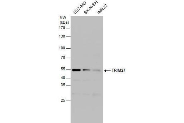 TRIM27 antibody